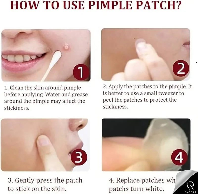 OyzekX Pimple Patch For Face